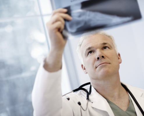 Male Doctor Examining An X-Ray Image - Colorado Center of Orthopaedic Excellence Broken Bone xray