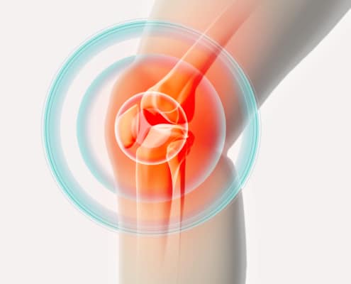 Knee painful - skeleton x-ray.