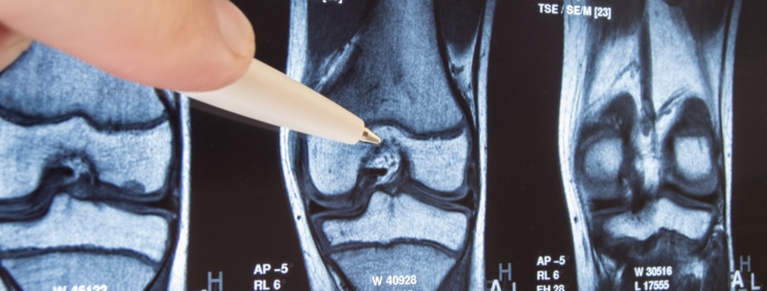 knee x-ray