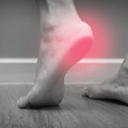 Plantar Fasciitis