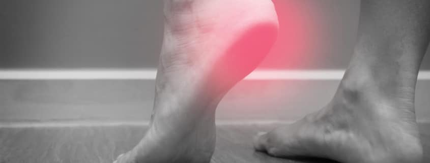 Plantar Fasciitis