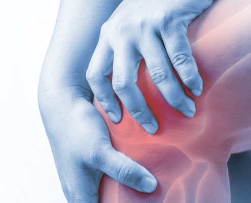 Total Knee Replacement Surgery