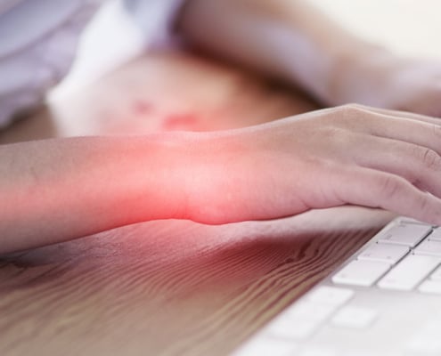 carpal tunnel