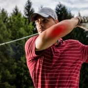 Golfer’s Elbow
