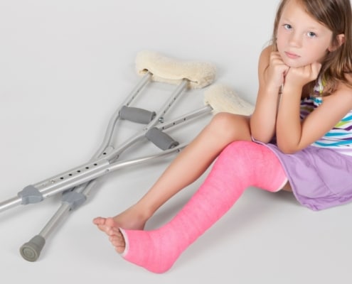 Tibia Shaft Fracture