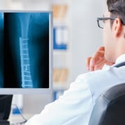 Femur Fracture