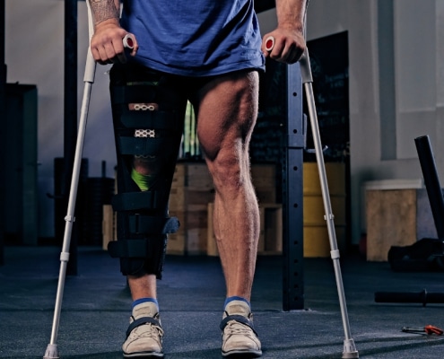 Distal Femur Fracture