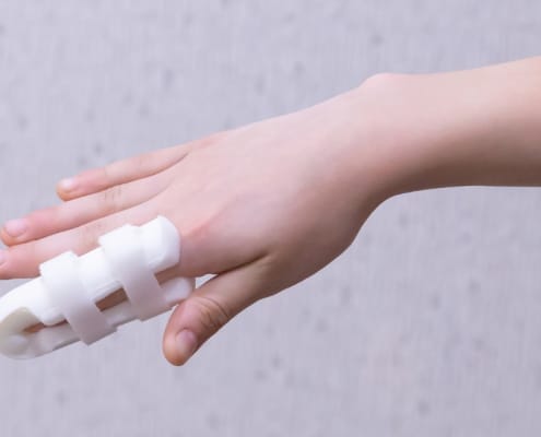 Finger Fracture