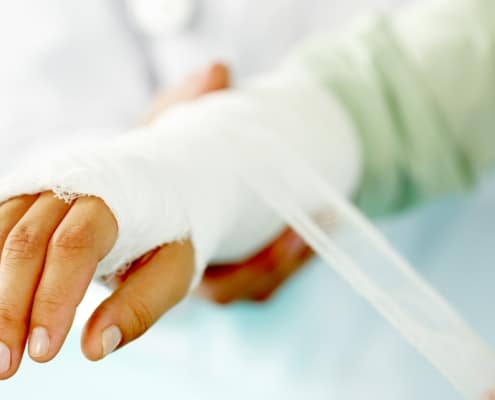 Hand Fractures